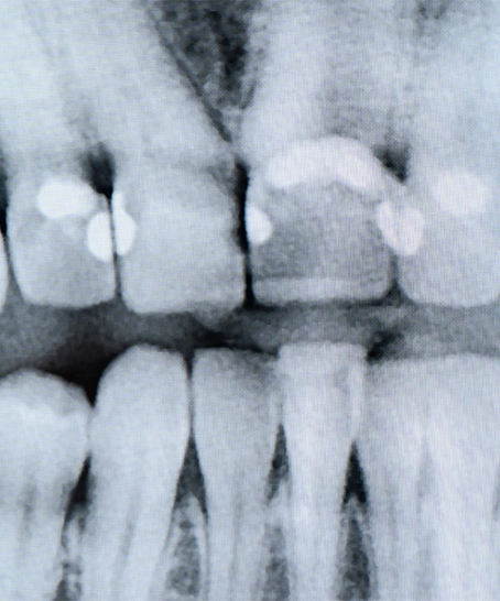 Behandlungsphilosophie Detail