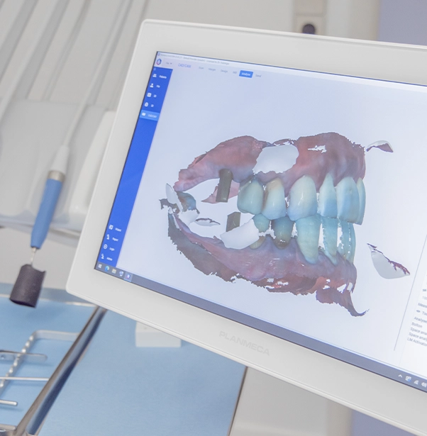 Digital Smile Design